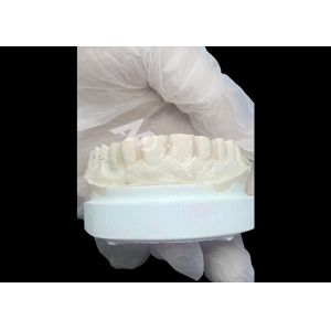 IPS Emax Veneers Minimal Prep/ No-prep Veneers Are Innovative Solutions For