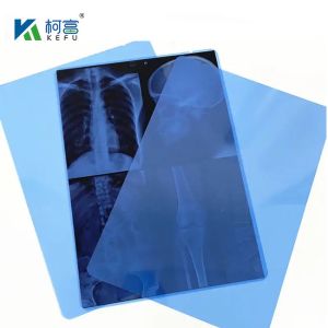 Buy cheap 10*12in Medical X-Ray / CT/DR Dry Scan Film For X-Ray Laser Image Printer And Thermal Image Printer Equipment from wholesalers