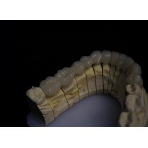 Buy cheap Layered Porcelain Fused Zirconia from wholesalers