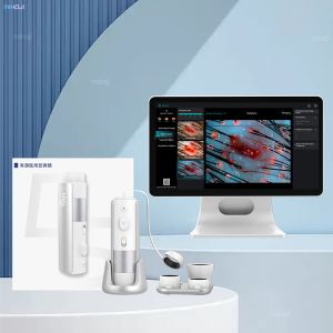 Customizable Scalp Analysis Machine For Dryness And Dandruff Problem