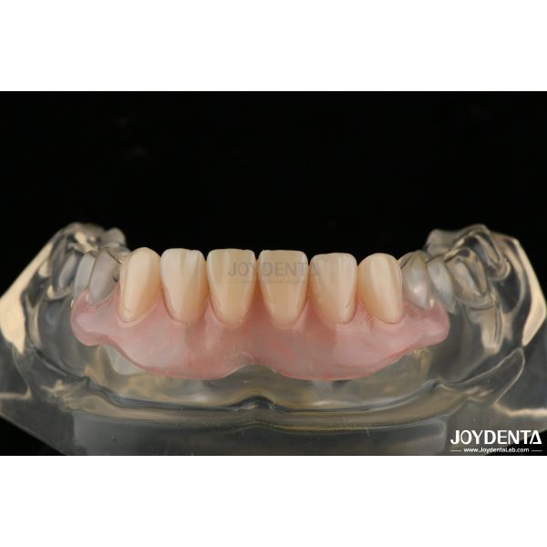 Buy cheap Personalized Invisible Denture Finished With Advanced Tooth Arrangement Technology from wholesalers