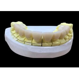 Zirconia porcelain Dental Crown with Aesthetic and Natural-Looking Finish from