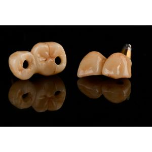 Buy cheap Self Tapping 3.0mm Thread Dental Titanium Implant Optimized Functionality from wholesalers