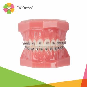 Buy cheap Easy Ligation Orthodontic Passive Self Ligating Brackets Damon Style from wholesalers
