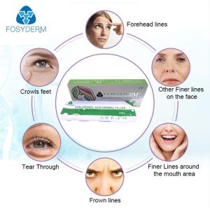 2ml Injectable Hyaluronate HA Dermal Filler Accept OEM