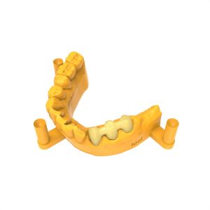 Low-Viscosity Permanent Crown Bridge Resin For Easy Handling