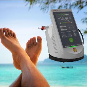 Buy cheap Class IV Podiatry Laser Onychomycosis Non Invasive Laser Treatment product