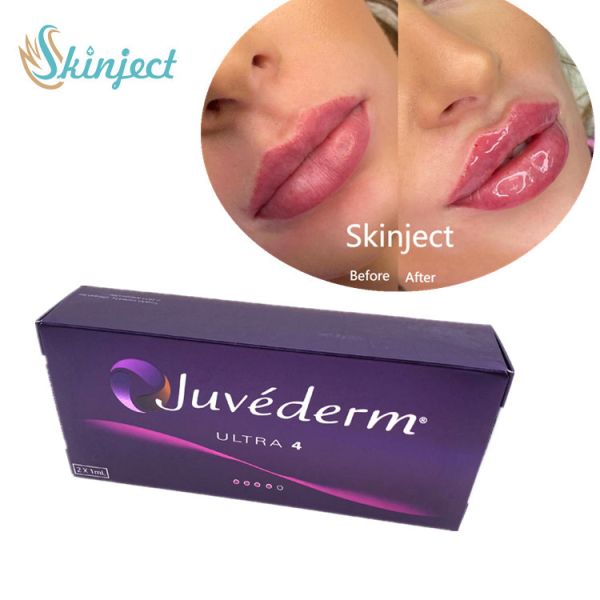 Buy cheap Juvederm 2*1ml Lips Filler Hyaluronic Acid Dermal Filler With Lido Ultra4 from wholesalers