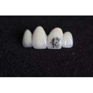 Buy cheap PFM Dental Crown Image Customization with personalized customized patterns from wholesalers