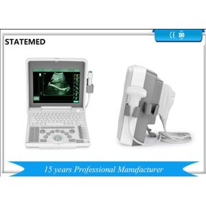 China Handheld Ultrasound Scanner / Echo Ultrasound Device Smoother Workflow on sale