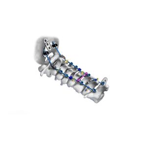 Buy cheap 40mm - 100mm CrCoMo Pedicle Screw Cervical Spinal Fusion System from wholesalers