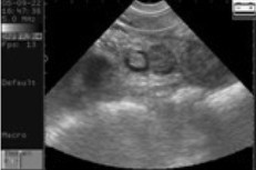 Buy cheap Digital Veterinary Ultrasound Scanner from wholesalers