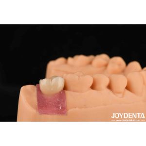 Buy cheap 4.1mm V Shaped Thread Titanium Abutments With Internal Hex Connection from wholesalers