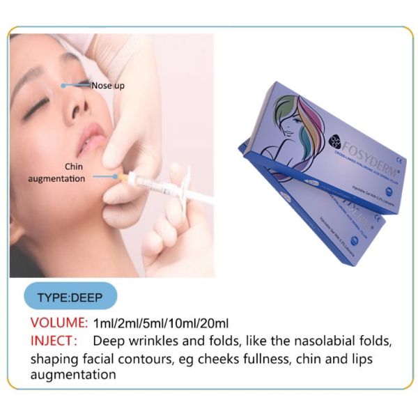 Fosyderm Deep Hyaluronic Acid 1ml HA Dermal Fillers Anti Aging
