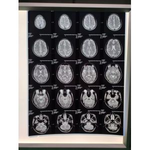 China 210 Microns Inkjet X Ray Film A3 on sale