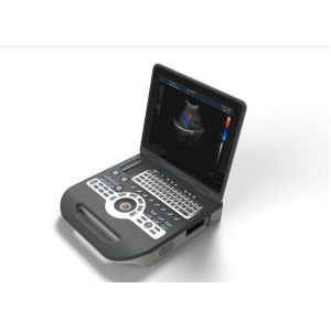Buy cheap 4d Ultrasound Machine Portable Ultrasound Scanner With 120G Capacity 4800 Frames​ Cine Loop from wholesalers