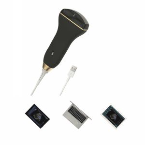 Buy cheap Digital Smart Handheld Ultrasound Scanner Wireless Ultrasound Probe For Puncture Guidance from wholesalers