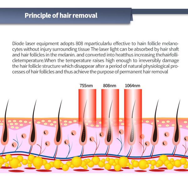 Efficient Diode Laser Hair Removal Machine with AC110V/60Hz Power Supply
