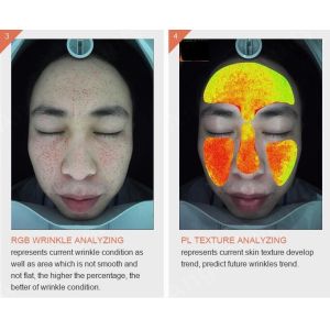 Buy cheap Handheld Wireless Wifi 3d Skin Analysis Machine Digital With Video Microscope from wholesalers