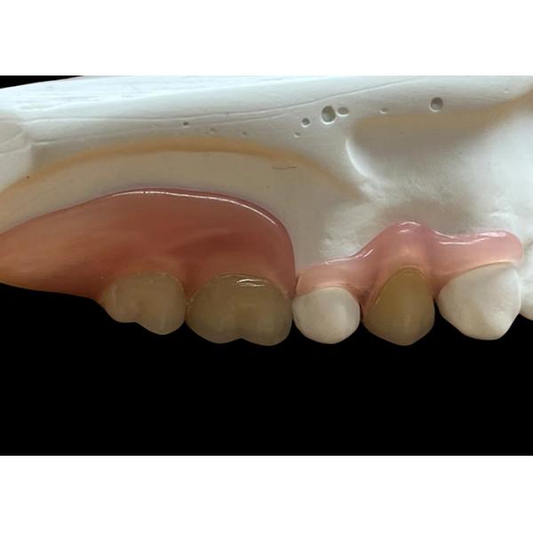 China Adjustable Invisible Flexible Denture: Secure Fit for Comfortable Chewing and Speaking with Varying Durability on sale China Adjustable Invisible Flexible Denture: Secure Fit for Comfortable Chewing and Speaking with Varying Durability on sale