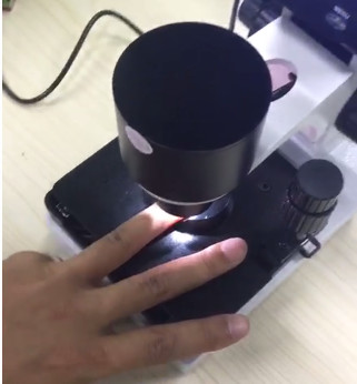 Next Generation Microcirculation Microscope , Blood Vessel Microscope For