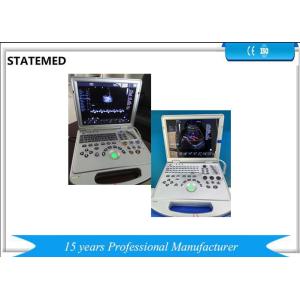Buy cheap 128 E Notebook Color Doppler Ultrasound System 375 × 350 × 80 Mm For Clinic from wholesalers