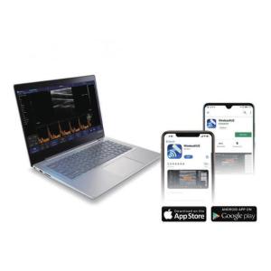 Buy cheap Ultrasonic Transducer Linear Convex Probe Handheld Ultrasound Scanner Wifi Connection Support Printing Reports from wholesalers