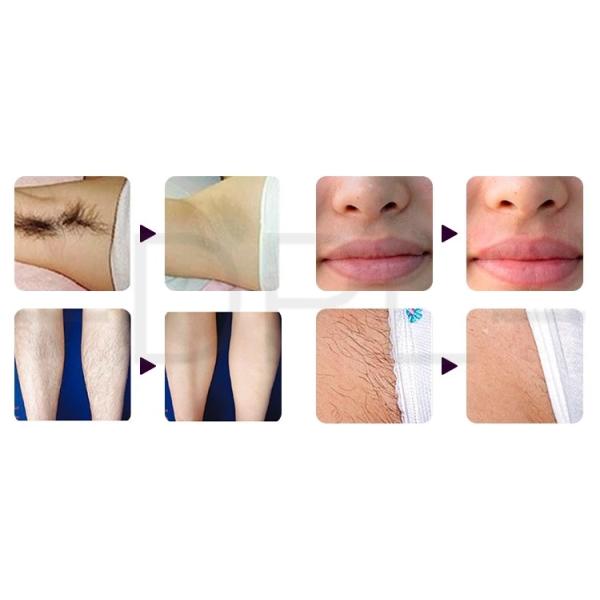 AS31Wholesale Diode Laser Beauty Machine 600W 2 in 1 IPL machine OPT Laser Painless Hair Removal device for salon beauty