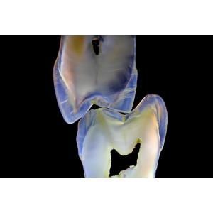 Buy cheap Fixed Prosthetics Permanent Solution EMAX Dental Crown from wholesalers