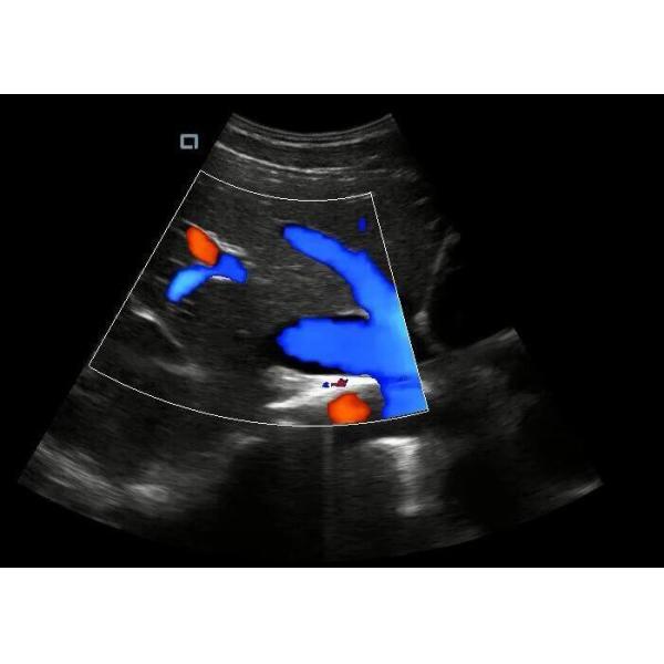 Quality 4D Function Optional Laptop Hand Held Doppler Machine With Transducer 2~12MHz for sale