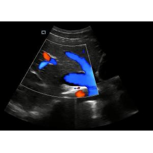 Buy cheap 4D Function Optional Laptop Hand Held Doppler Machine With Transducer 2~12MHz from wholesalers