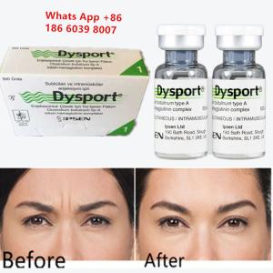 Buy cheap Botulinum Toxin Type A Dysport Injection for Wrinkle Reduction from wholesalers