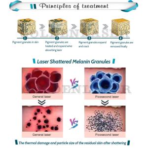 China Say Goodbye to Unwanted Hair with 1000W Handle Power Home Laser Hair Removal Device on sale