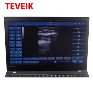 Buy cheap Medical Ultrasound Instruments USB Protbble Ultrasound Linear Probe from wholesalers