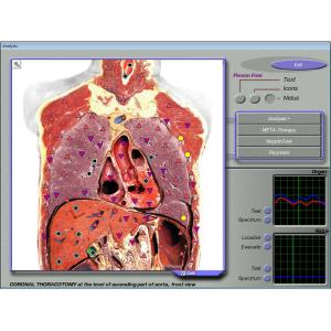 Buy cheap Quantum 3d Nls Health Analyzer , Non-linear Analysis System from wholesalers