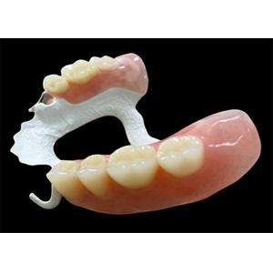 Quality Customized Partial Removable Denture with High-Performance Polymer (HPP) for sale Buy cheap Customized Partial Removable Denture with High-Performance Polymer (HPP) product
