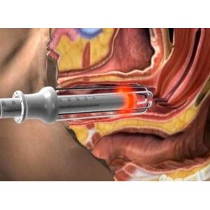 Buy cheap Coherent, USA RF Tube Fractional CO2 Laser Vaginal Tightening/wound healing process Skin Rejuvenation Machine from wholesalers