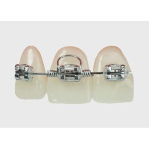 Buy cheap Spring-Type Tooth Torque Spring - Essential Orthodontic Supplies for Orthodontic Kits & Ortho Accessories | High-Quality Orthodontic Products from wholesalers