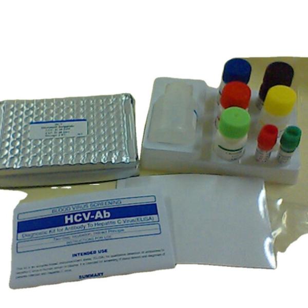 Buy cheap Toxo Igg Elisa Test Kit Medical Device MFDS Approved from wholesalers