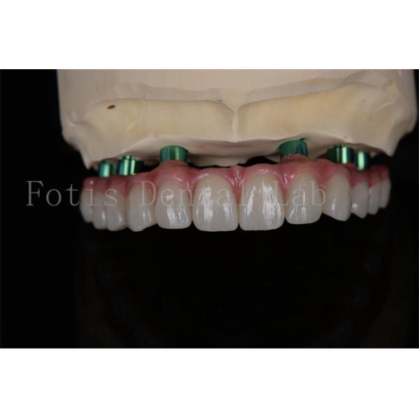 Buy cheap Zirconia All-on-4 Implant Procedure Same Day Recovery Minimal Follow Up Needed from wholesalers