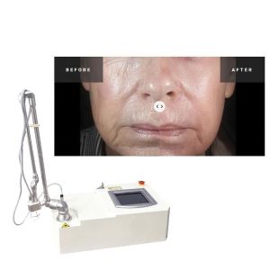 Buy cheap Portable 15w Co2 Fractional  Acne Surgical Scar Laser Machine from wholesalers