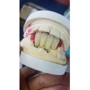 Buy cheap Smooth Surface Biocompatible Zirconia Tooth Crown Easy Maintain from wholesalers