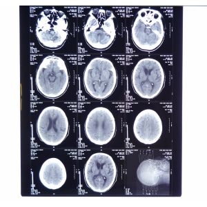 Buy cheap Custom 8 X 10 Digital Medical Dry Film from wholesalers