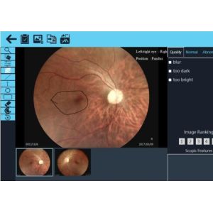 1920 X 1080 Pixels 3.5" Video Ophthalmoscope Device