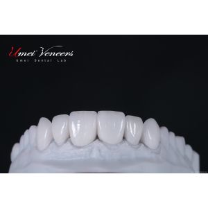 Buy cheap Flawless cast porcelain veneers from wholesalers
