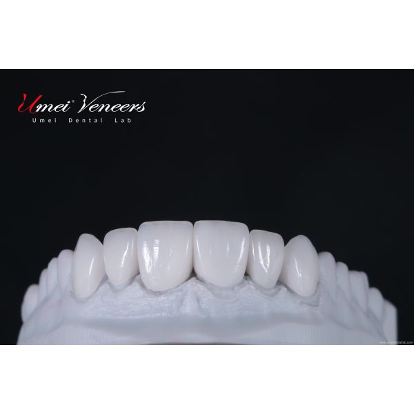 Buy cheap Flawless cast porcelain veneers from wholesalers
