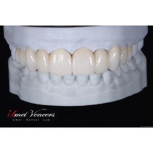 Buy cheap Flawless cast porcelain veneers from wholesalers