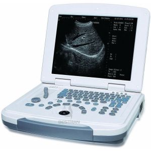 Buy cheap Laptop Ultrasound Scanner from wholesalers