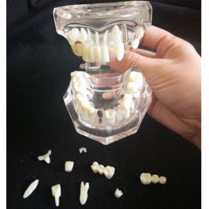 Buy cheap Removable Dental Materials Activity Pathological Teeth Model from wholesalers
