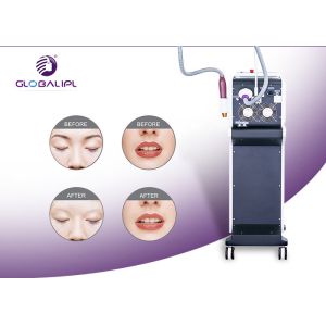 Buy cheap High Energy Pico Yag Laser Tattoo Removal For Salon And Clinic Use from wholesalers